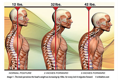 Prevent Tech Neck and Back Strain