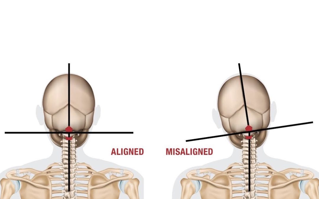 Chiropractic Care for Athletes