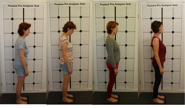 Chiropractic Care and Better Posture